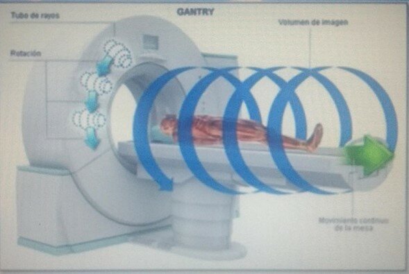 Surge la TC helicoidal