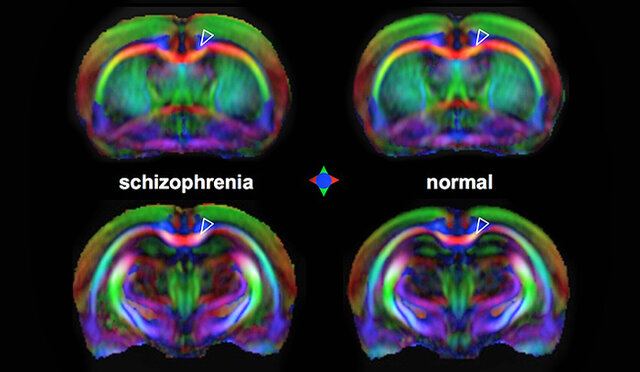 Detectar enfermedades