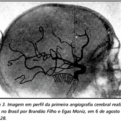 Timeline: Angiografía
