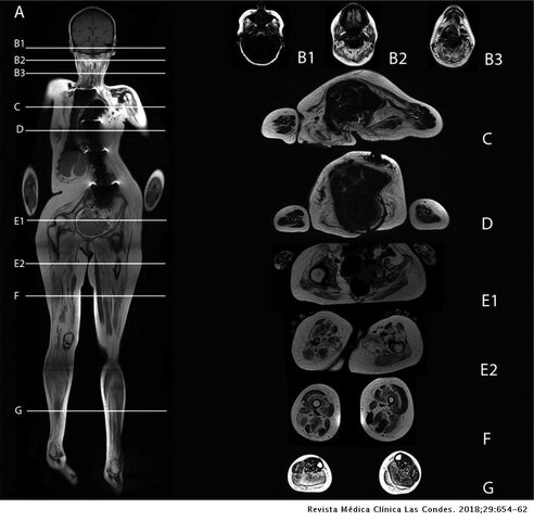 Resonancia magnética