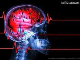 Muerte Cerebral