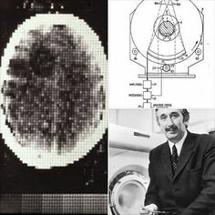 tomografía computarizada (TC)