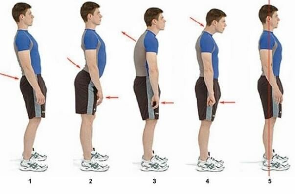 10.	Técnicas de alexander.1890