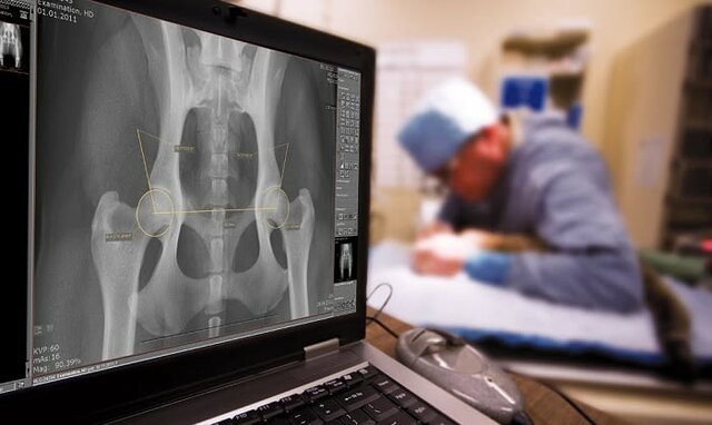 Rayos X  se convierten digital