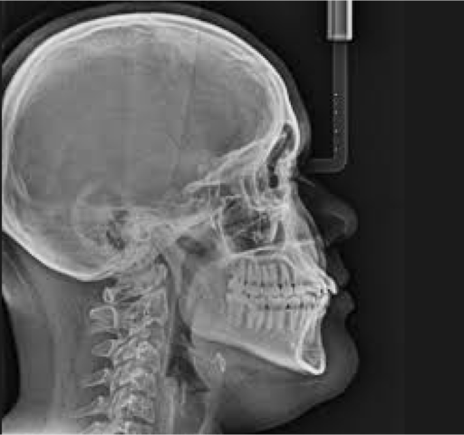 Magnitudes, unidades y limitación de dosis de radiación utilizadas