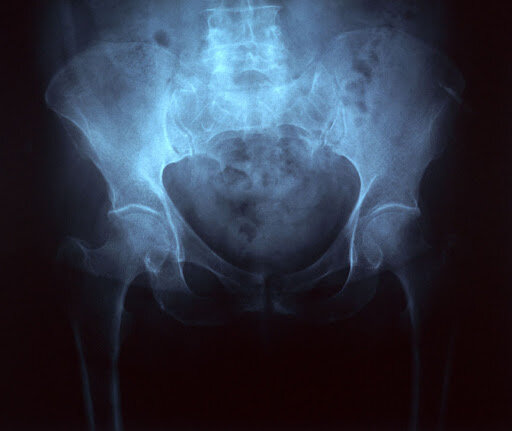 Magnitudes, unidades y limitación de dosis de radiación utilizadas