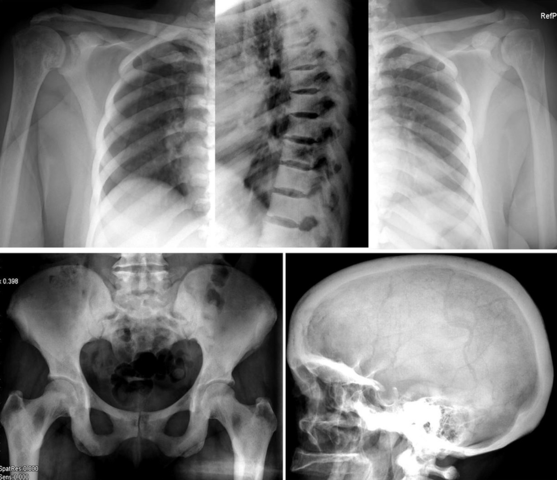 Demostración de los rx