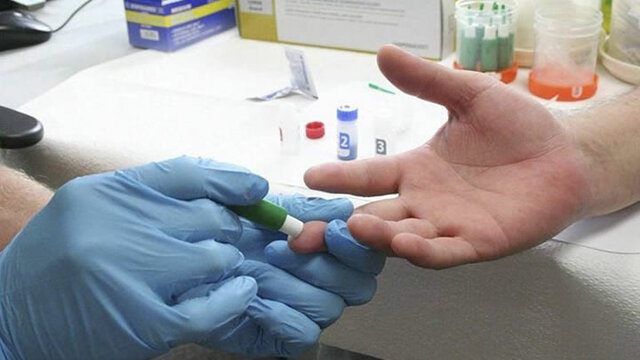 Se emplea la primera prueba específica para la identificación del virus de la hepatitis C (HCV)