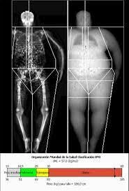 Absorciometría de rayos x