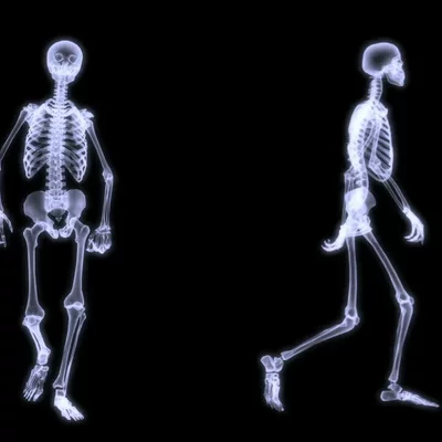 Timeline: Radiologia- Cominzos, hasta hoy.