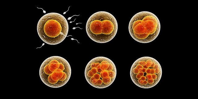 Flemming (1843-1905)