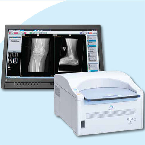 Radiografia computarizada