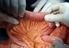 Descubrimiento del mesenterio