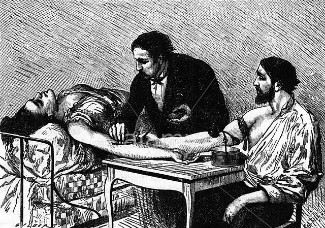 Éxito en transplante de sangre