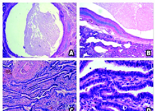 El aumento de diámetro en el microscopio
