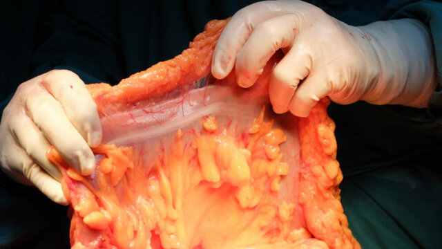 Descubrimiento del 79º órgano del cuerpo humano