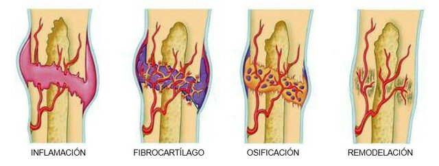 fase de remodelación