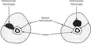 clasificación de las lesiones deportivas