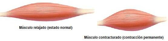 lesiones musculares intrínsecas