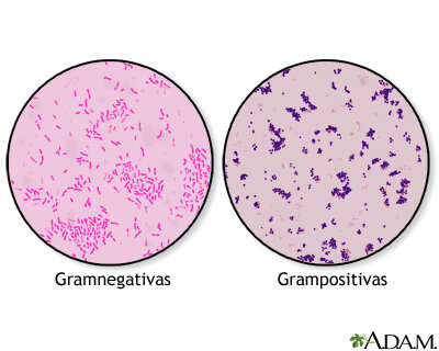Desarrollo de la tinción de Gram.