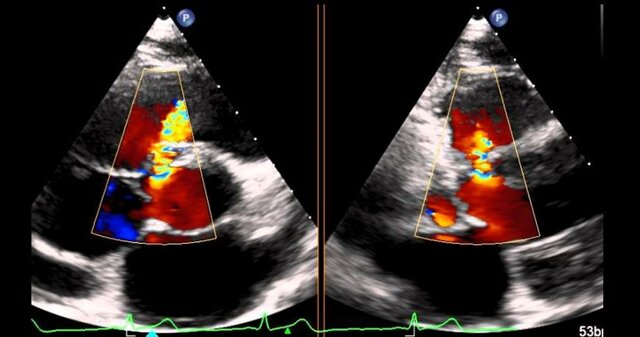 Aplicaciones actuales de la graficación por computadora