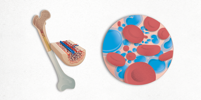 Comienza programa de trasplante de células hematopoyéticas en el hospital La Raza del IMSS