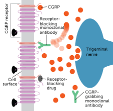 New medicine for migraines
