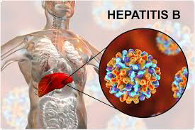 Hepatitis b cure
