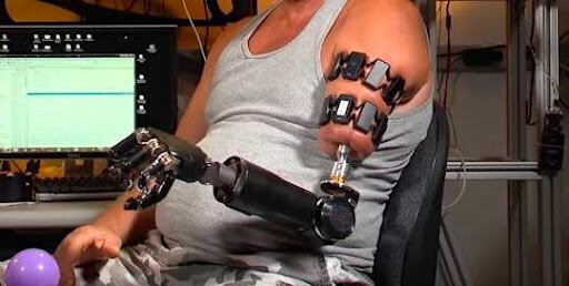 Se crea la primera prótesis que se conecta directamente a los huesos.