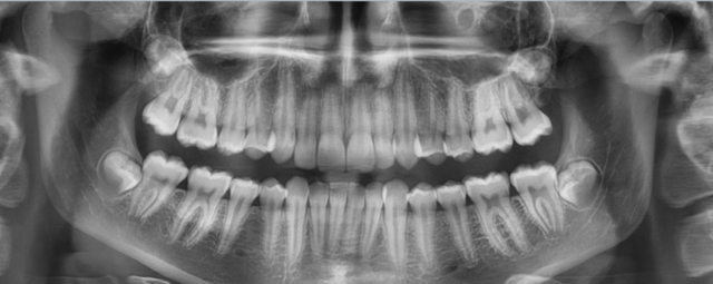 William Herbert Rollins