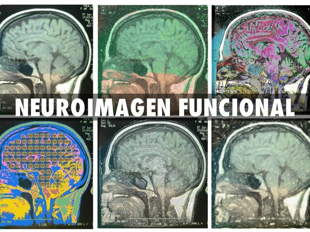 Investigación con el empleo de imágenes funcionales