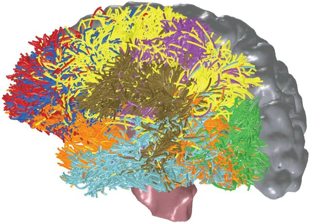 Correlaciones clínico-anatómicas