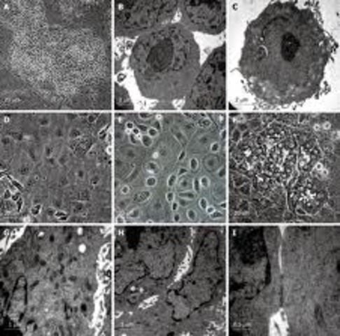 Van Leeuwenhoek sent letters to British Royal Society describing microscopic observations 