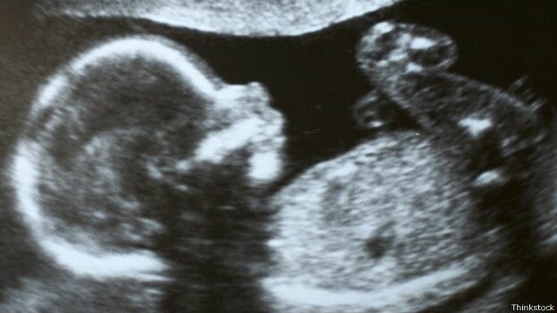 Parto complicado: una cabeza muy grande