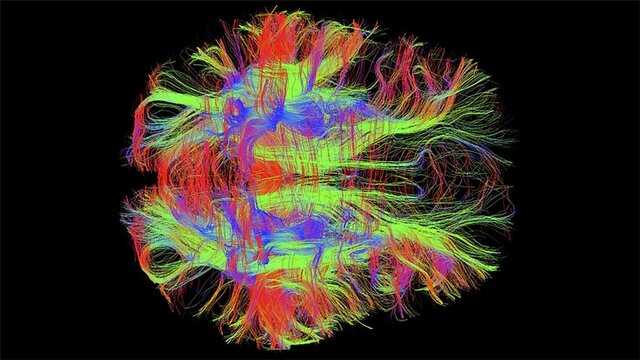 Fibras microscópicas, Universidad Técnica de Liberec