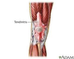Fase de Remodelación o Maduración