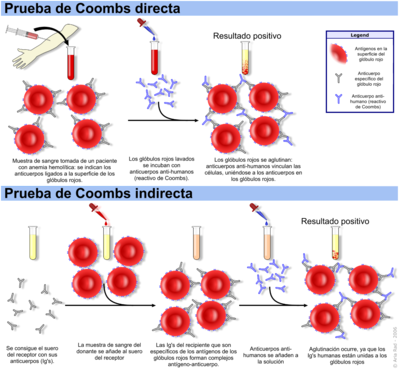 Descripción de la prueba de Coombs