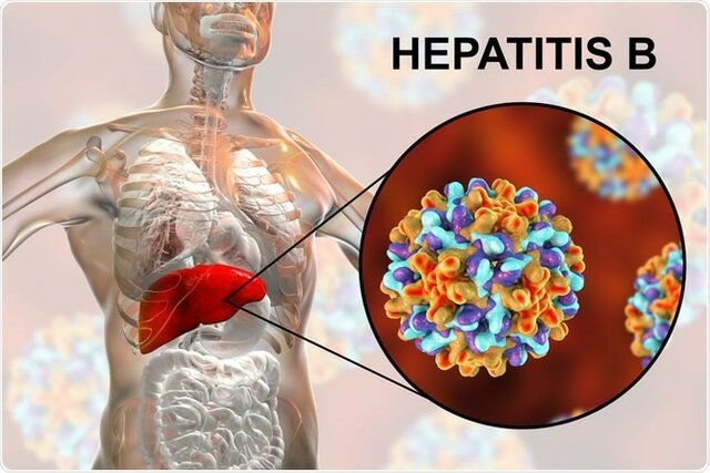 Hallazgo del antígeno de la Hepatitis B