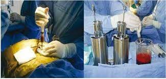 Separación de células progenitoras hematopoyéticas