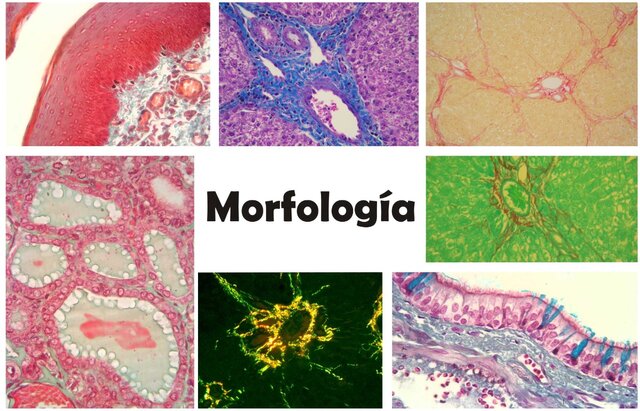 MORFOLOGÍA