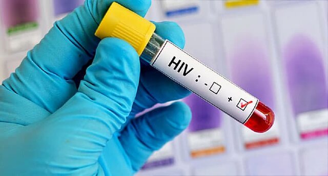 Implementación de pruebas para detectar el VIH en bancos de sangre.