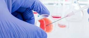 Programa de transplante de células hematopoyéticas en México