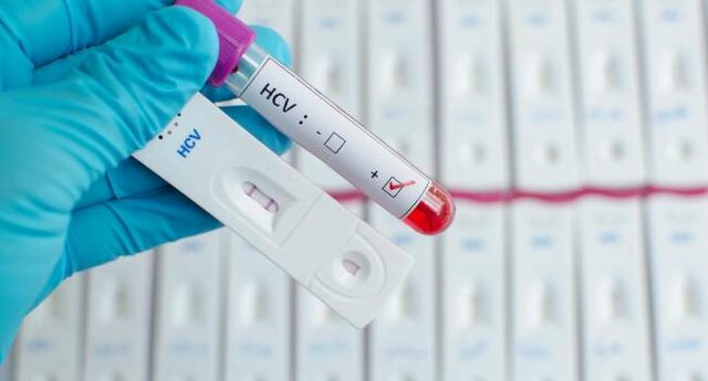 Primera prueba para la detección  del virus de la Hepatitis C