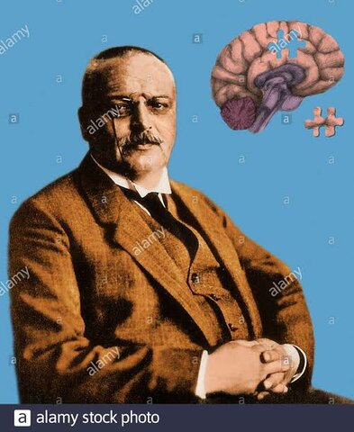 Alzheimer (1988)