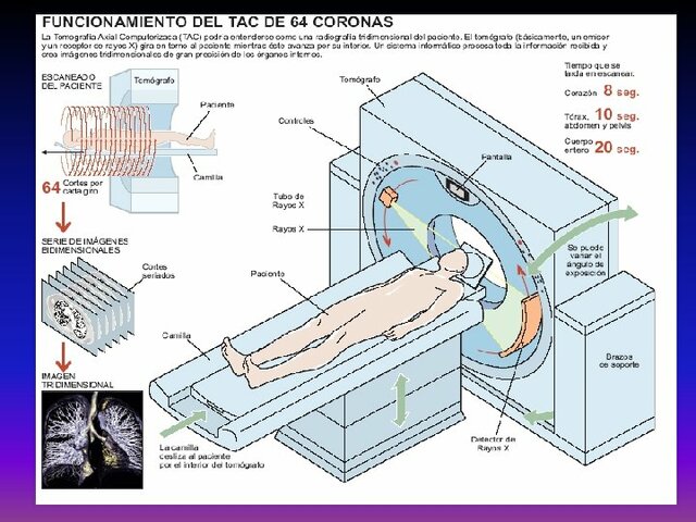 SURGE LA TOMOGRAFÍA