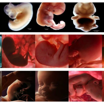 Timeline: Desarrollo Prenatal