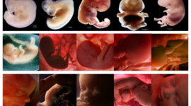 Timeline: Desarrollo Prenatal