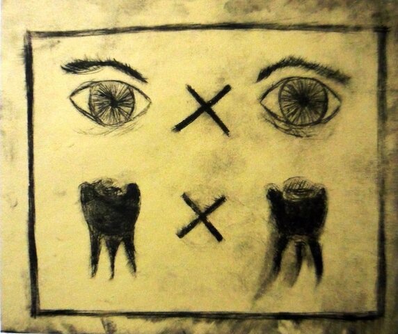 Mesopotamia;  Ley Talión indemnizaciones de accidentes (OJO POR OJO Y DIENTE POR DIENTE)