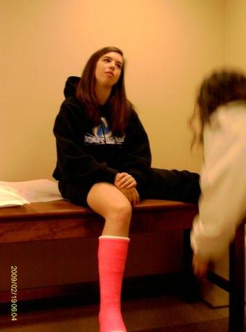 duelo mi tobillo y recibí un yeso