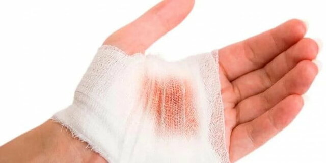 Atención a trabajadores